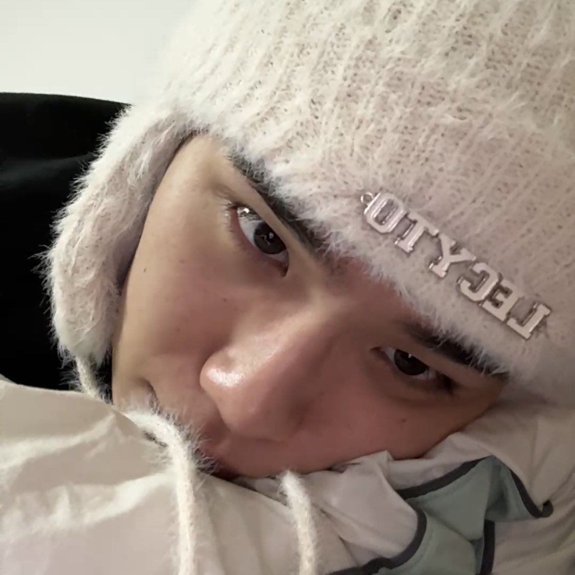 singerppuppy's tweet photo. who else is thinking about taerae's freckles https://t.co/FXkJJ68yLm
