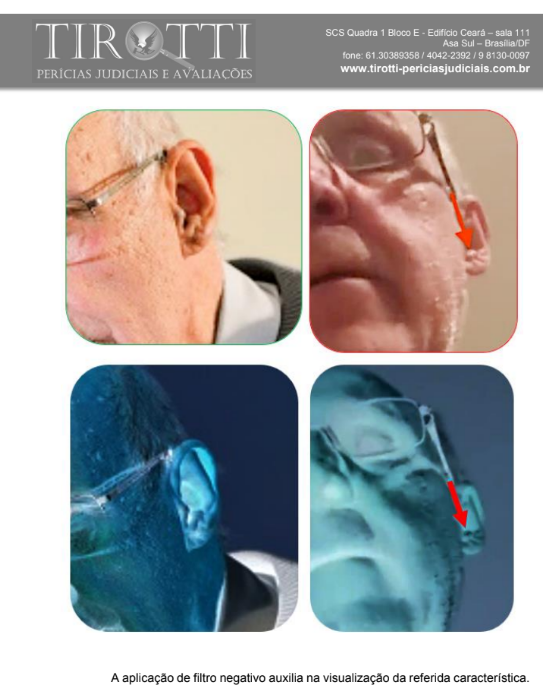 Apesar das críticas aos peritos do caso do Lançaleite, não vi ninguém contestar tecnicamente a perícia, que no caso são duas, feitas por peritos diferentes em diferentes épocas. Nem se quer vi nenhum dos críticos desses peritos processa-los judicialmente, já que no caso, forjar