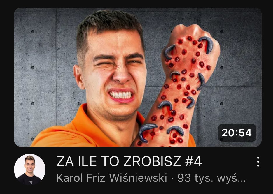 KarolZdeba's tweet photo. Moja trypofobia dostała trypofobii 💀 https://t.co/xg2PHxtYZt