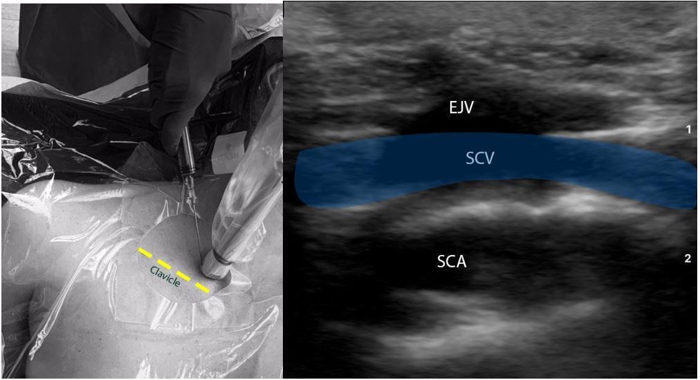 NephroPOCUS tweet media