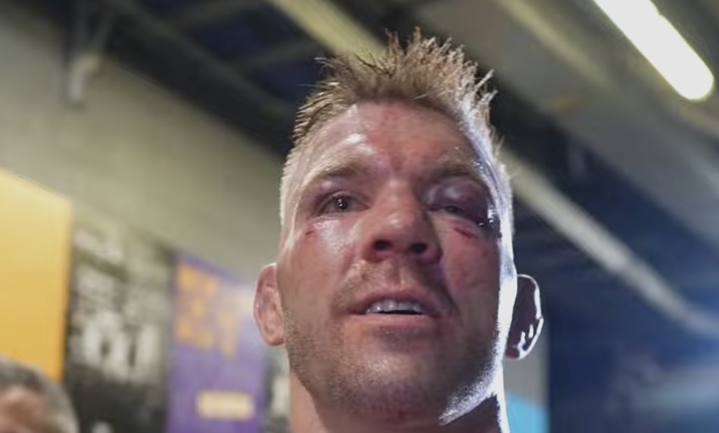 With no context besides these photos who won the fight