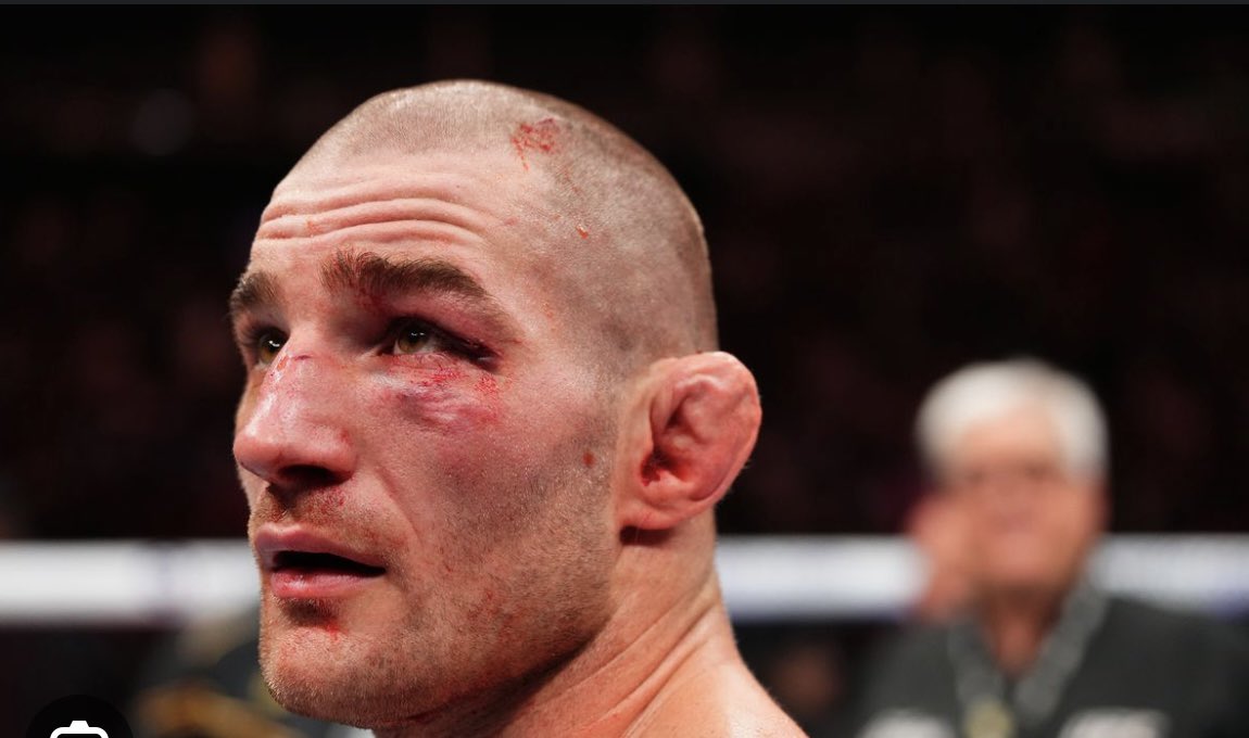 C_A_B1's tweet photo. With no context besides these photos who won the fight https://t.co/cIqx9m81Od