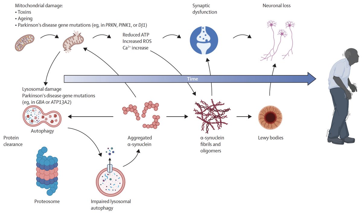 EricTopol's tweet photo. The 2nd most common neurodegenerative disease is Parkinson's. This week's @TheLancet has it covered with 3 review papers on what we know about its mechanism, epidemiology and treatments
https://t.co/9j3wTic5gS @huwmorris @PDandHDLab https://t.co/tzPYF5GdRR