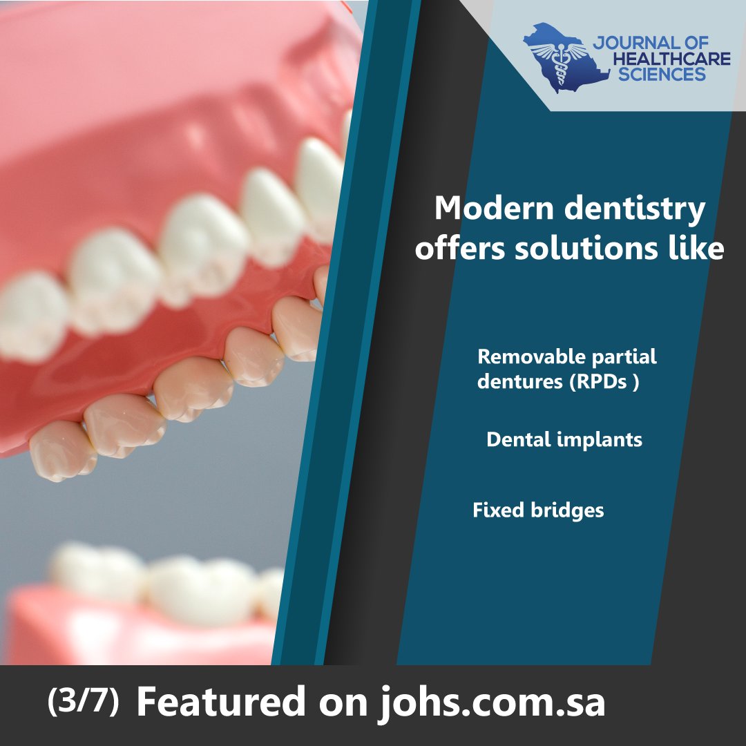 johssaudi's tweet image. Modern dentistry is revolutionizing solutions for tooth loss.  🔧🦷
.
.
#dentalsolution #prosthodontics
.
.
Compare options👉josh.com.sa