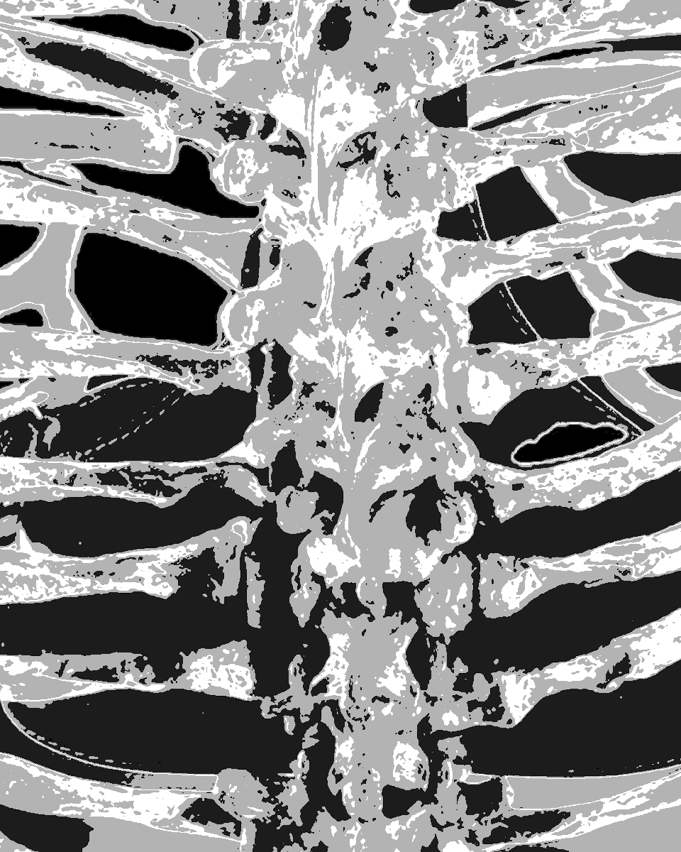 dianavokhid's tweet photo. Day 12/30
"Bone sound"
#Bones #body #skin #spine #backbone #chain #vertebralcolumn #note #graphics #GraphicDesign #ps #photoshop #some #ppl #need #some #spine
#love #light #and #huge #hugs #littlecrows https://t.co/ZEUTvBg9ZD