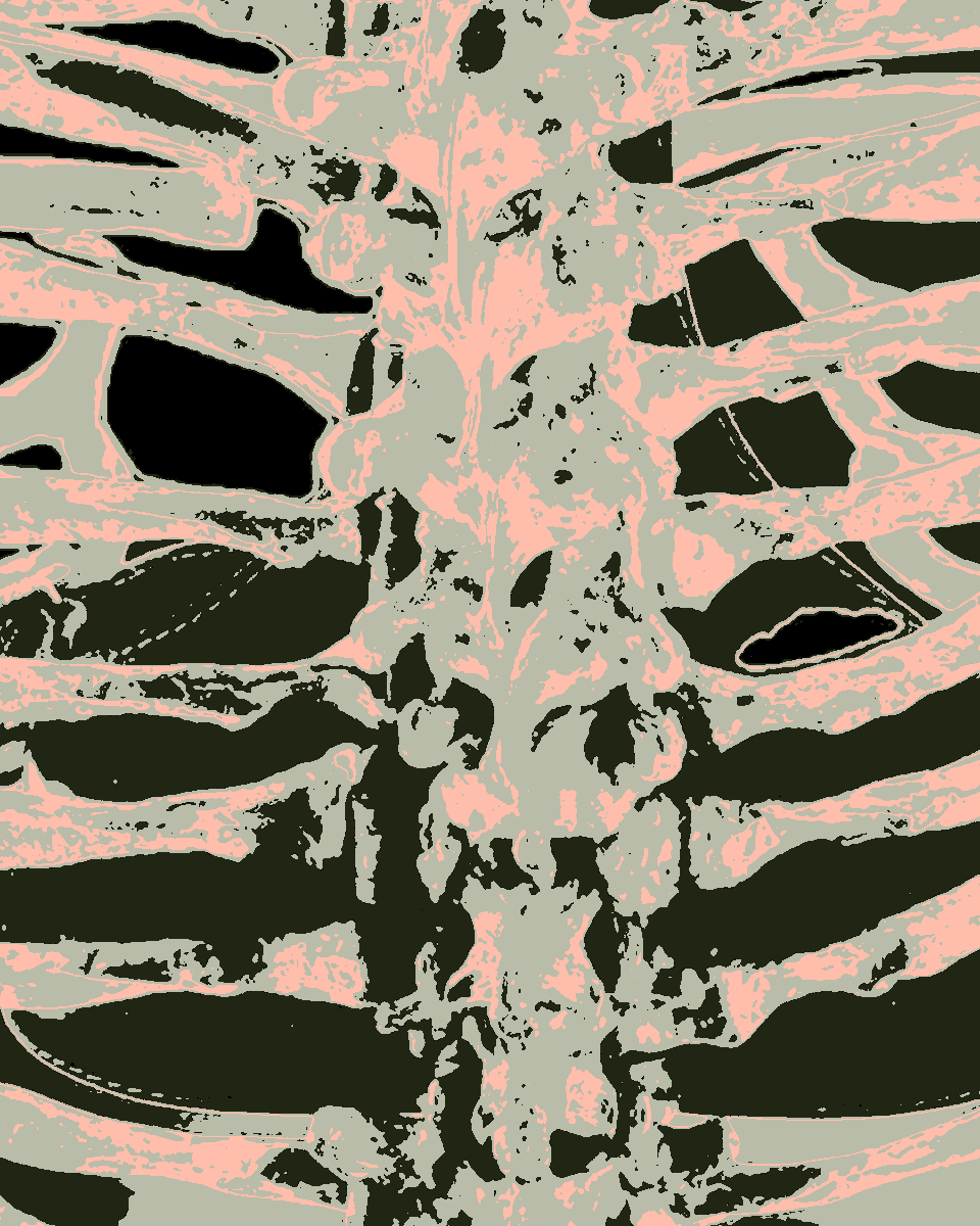 dianavokhid's tweet photo. Day 12/30
"Bone sound"
#Bones #body #skin #spine #backbone #chain #vertebralcolumn #note #graphics #GraphicDesign #ps #photoshop #some #ppl #need #some #spine
#love #light #and #huge #hugs #littlecrows https://t.co/ZEUTvBg9ZD