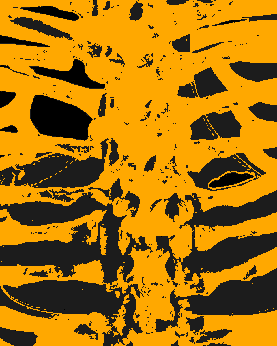dianavokhid's tweet photo. Day 12/30
"Bone sound"
#Bones #body #skin #spine #backbone #chain #vertebralcolumn #note #graphics #GraphicDesign #ps #photoshop #some #ppl #need #some #spine
#love #light #and #huge #hugs #littlecrows https://t.co/ZEUTvBg9ZD