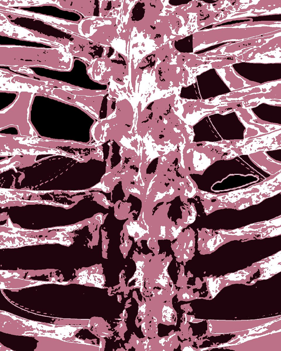 dianavokhid's tweet photo. Day 12/30
"Bone sound"
#Bones #body #skin #spine #backbone #chain #vertebralcolumn #note #graphics #GraphicDesign #ps #photoshop #some #ppl #need #some #spine
#love #light #and #huge #hugs #littlecrows https://t.co/ZEUTvBg9ZD