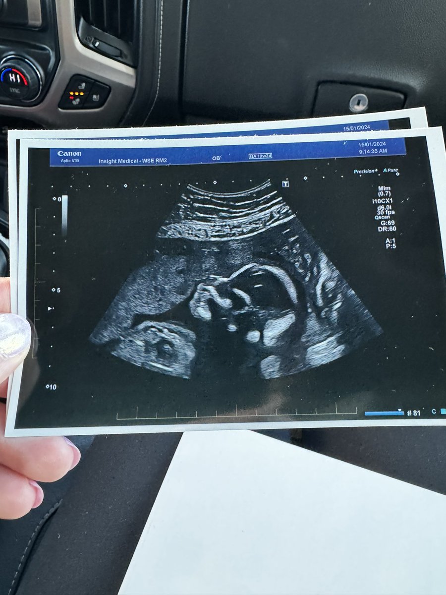 It’s a boy and Mia said we can name him Arthas if we get 1 million likes. <a href="/gunzznbunzz/">gunzznbunzz</a>