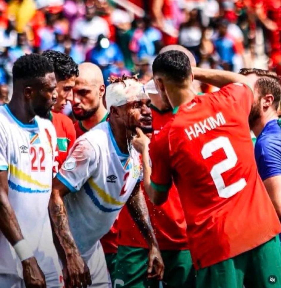 Cette image mérite +1000 Likes 🇨🇩🤜🏽🤛🏽🇲🇦 #proudlyafrican ##CAN2023