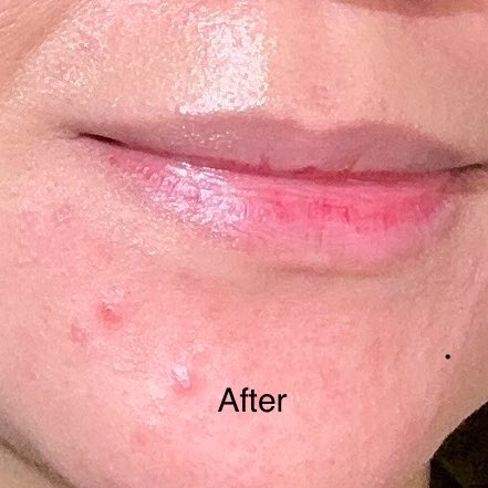 angelictorns's tweet image. SOBAT QUARTER LIFE CRISIS, SAATNYA PAKE SERUM INI 🥹☝🏻

Udah bosen pake retinol? Butuh upgrade? Kata aku masukin serum ini ke list serum yang wajib dicoba tahun 2024!

— #racuninskincare