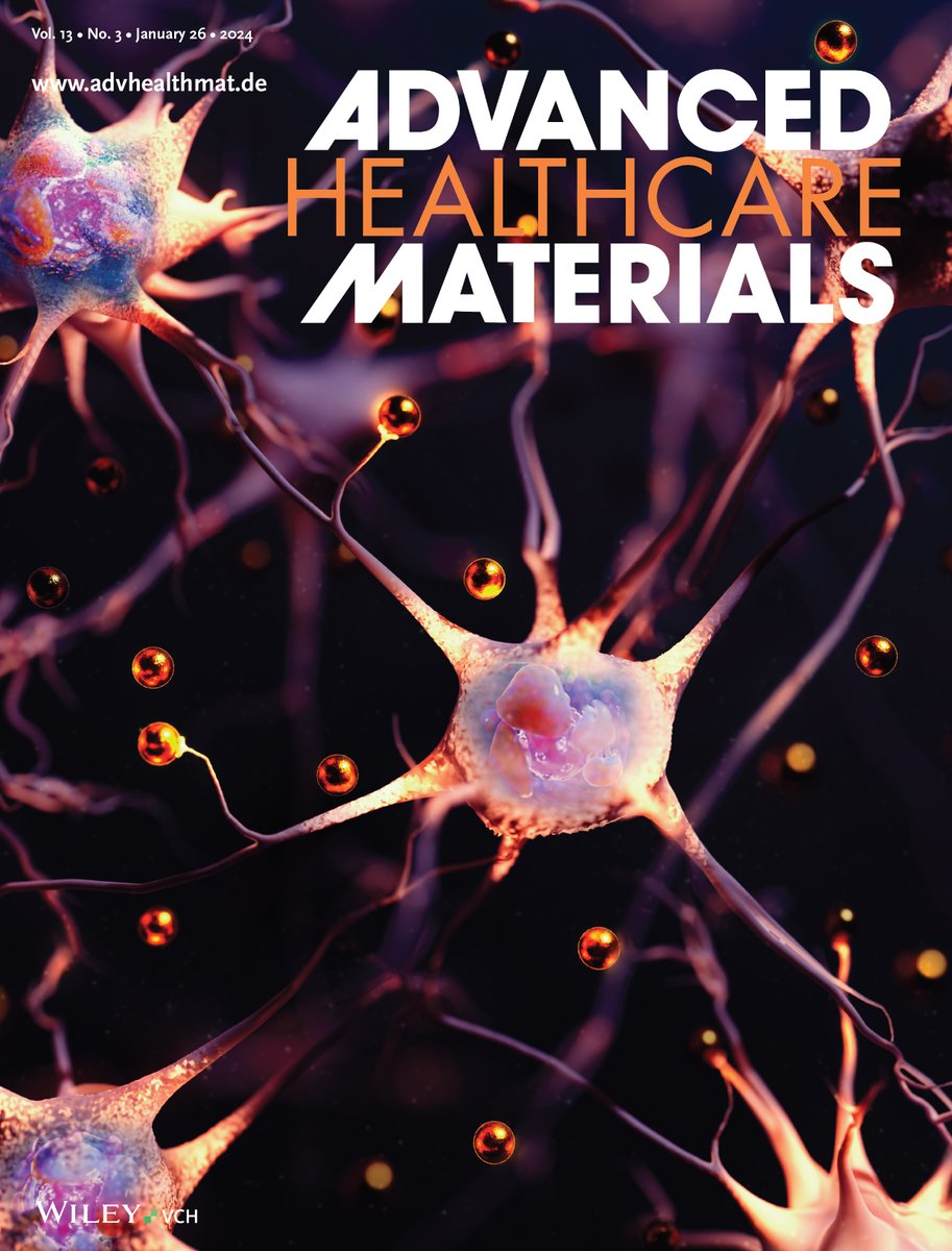 Neurogenesis using carbon nanodots nanocomposites. A new cover art by ScienceBrush Design featured in Advanced Healthcare Materials! Work led by Prof. Fabio Variola and colleagues. onlinelibrary.wiley.com/doi/10.1002/ad… #SciArt #neurons #neurogenesis