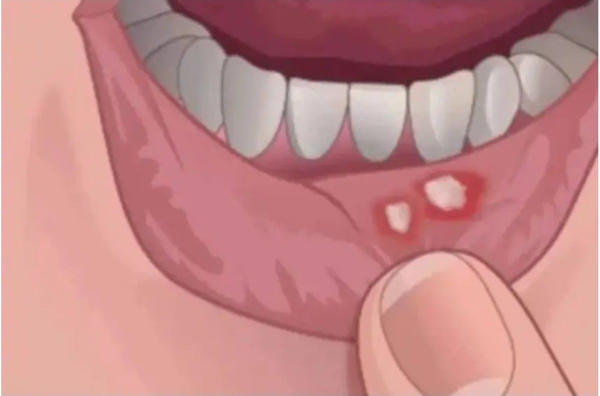 PostbyPeter's tweet image. Please what causes this and how can it be treated 🤔🙏