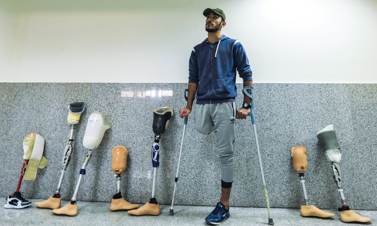 arabnews's tweet photo. #SPOTLIGHT: Even prior to #October7, 21% of households in #Gaza had at least 1 member with a disability. Now the conflict has robbed them of care &amp; dignity https://t.co/AdKS1vH38a https://t.co/J9HWcbe9kL
