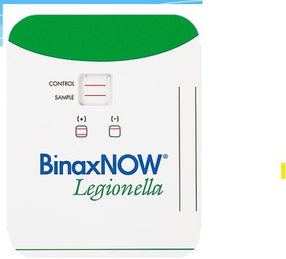 Legionella pneumophila - water supply systems, cooling towers, hot water spas
Respiratory specimens, BCYE agar, No Growth on BAP
Catalase +, Oxidase v, urea =, MALDI 
#lab4life #pathtwitterAward #IDBoardReview #micromeded #medlabchat #path