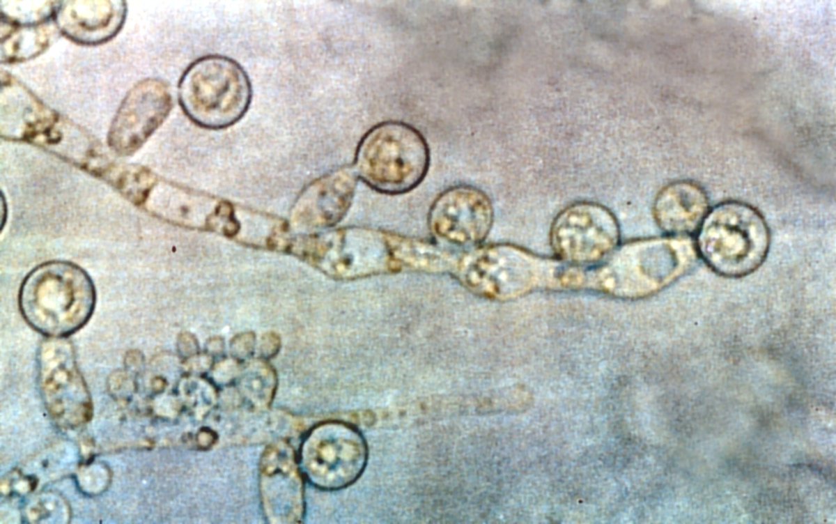 HiddenNatureYT's tweet photo. Candida Albicans: Un Agente Inusual de Meningitis 🧫🧠: Isabel Sánchez Morcillo, estudiante de Bioquímica en la Universidad de Granada, nos sumerge en el complejo mundo de la meningitis y su relación con la Candida albicans en su artículo para Hidden Nature. https://t.co/GgsbFhHVjK
