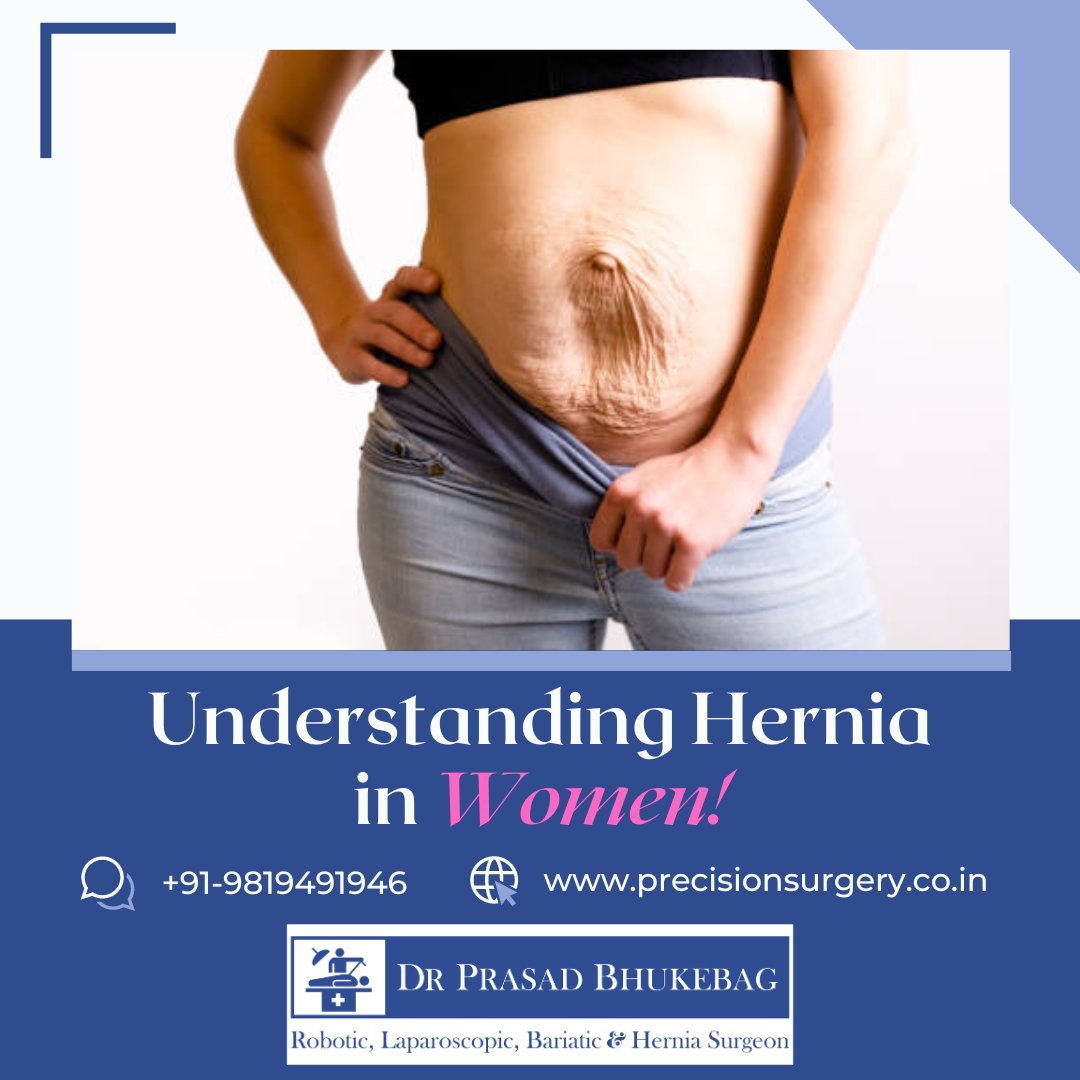 Understanding Hernias in Women: A Comprehensive Guide

instagram.com/p/C2YuOl-hLiA

#WomensHealth #HerniaAwareness #HealthcareForHer #EmpowerHerHealth #IncisionalHernia #VentralHernia #InguinalHernia #FemoralHernia