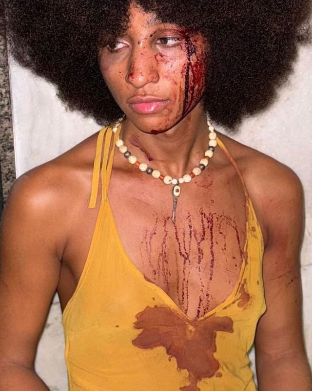 karlmarxsilv's tweet photo. 🚨 Três Mulheres Foram Brutalmente Espancadas Após Samba no Rio de Janeiro! 🧶 https://t.co/Qls6H1wrM6
