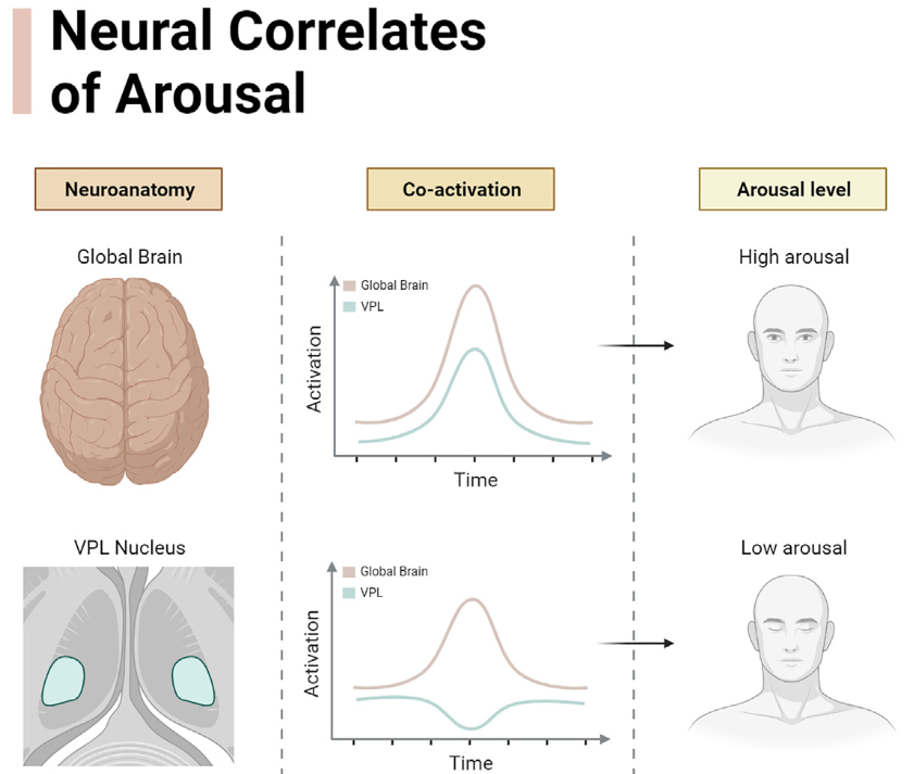 New article is out! Check it out here:
static1.squarespace.com/static/528facb…
#fMRI #arousal #neuroscience #Science #affection