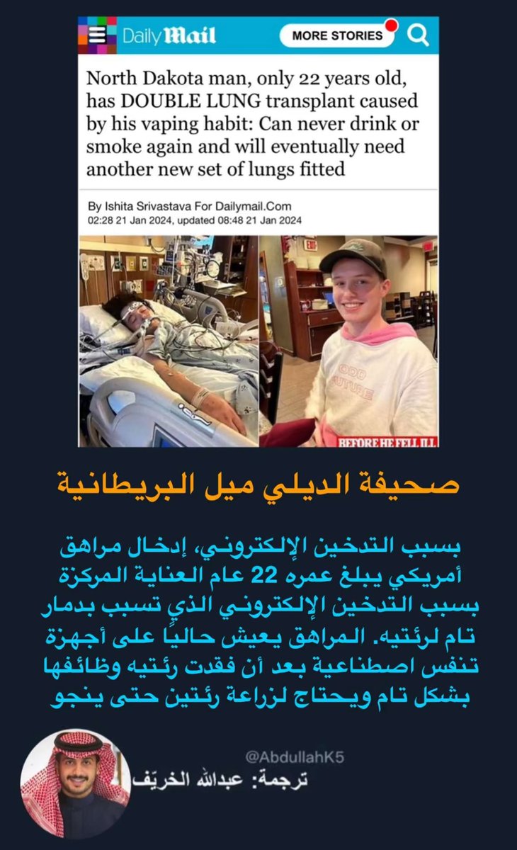 AbdullahK5's tweet photo. مراهق أمريكي بالعناية المركزة بسبب الدخان الالكتروني "الڤيب" 

*للأسف منتشر جدا عند المراهقين وبعض الكبار لدرجة يضعونه ميدالية على أعناقهم ويستمرون بالتدخين طوال اليوم https://t.co/pejVqwqwGz