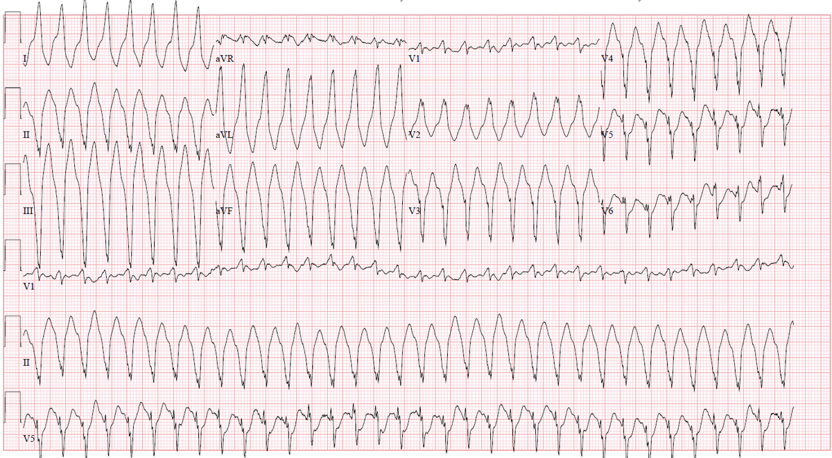 ECG Reid tweet media