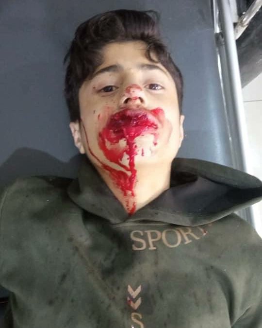 Syrianrev2011's tweet photo. 4 إصابات حتى الآن https://t.co/1Q0HqoMXvb