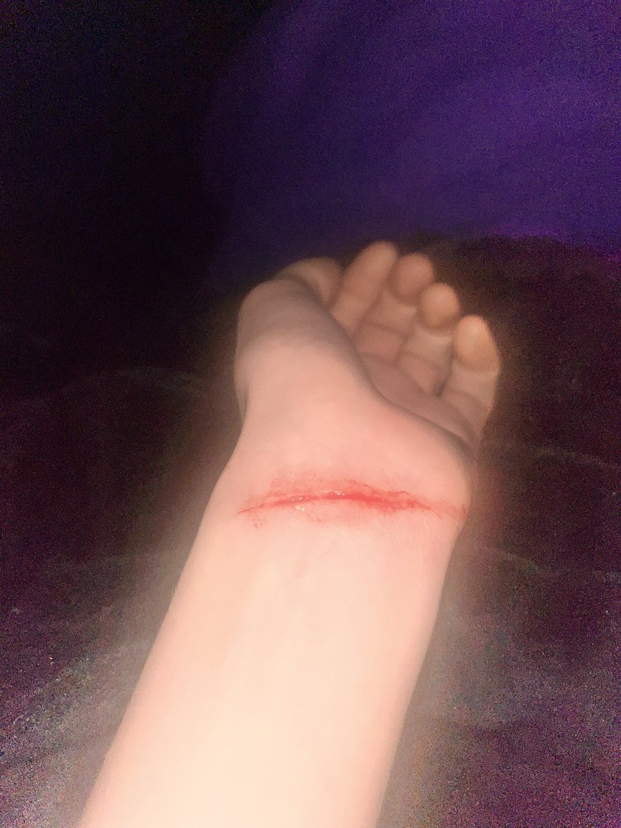 soulessred's tweet photo. There was an exacto kn1fe sitting upright in my bed and I just woke myself at 6am when I shifted positions bc I accidentally did a styro on my wrist 💀 https://t.co/sethhwqQiw