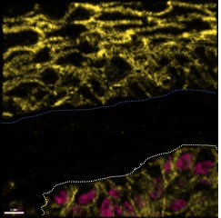 crctoncopole's tweet image. 🇫🇷 Étude de la contribution de lipides tumoraux dans l’évolution métastatique d’un mélanome cutané. Publié dans @CellReports 12/2023 par l'équipe @melasphinx du @crctoncopole . #oncométabolisme, #lipides, #Cancer , #peau, #ingénierietissulaire
➡️crct-inserm.fr/etude-de-la-co…