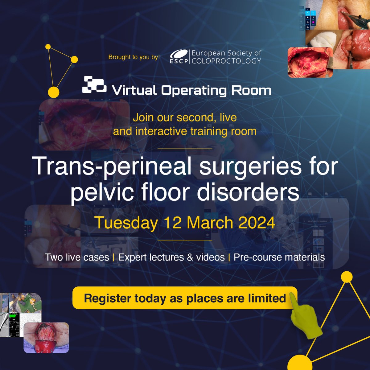 Join our second Virtual Operating Room event on Trans-Perineal Surgeries on 12 March!

Register today for live and interactive cases: i.mtr.cool/dzdmhgdstm

#PelvicFloorSurgery #LiveSurgery