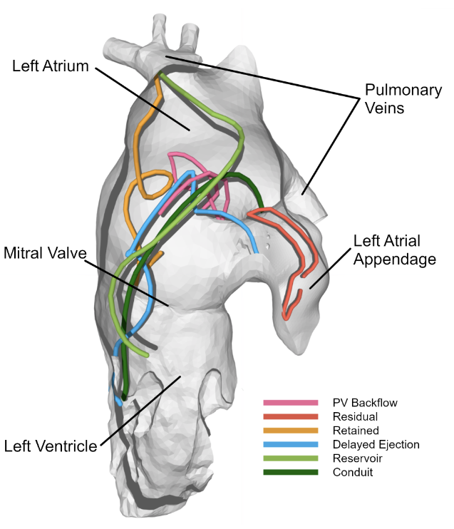 ajpheartcirc's tweet photo. #ArticlesInPress: Comprehensive Left #Atrial Flow Component Analysis Reveals Abnormal Flow Patterns in #Paroxysmal Atrial Fibrillation
(Sophia Bäck et al.)
https://t.co/6zcJYLRTZA
@_SophiaBack @liu_universitet
#AtrialFibrillation #FlowComponentAnalysis https://t.co/OBEoADSYvY