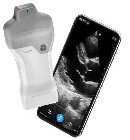 Cuando me preguntan qué USG les recomiendo para hacer #POCUS nunca les digo alguno en específico, pero existe un estudio al respecto: Al probar 4 USG, el que más se comprarían los médicos es: #VSCAN AIR de GE 🥇 luego el #lumify 🥈 luego el #kosmos 🥉 y al final (sorpresa!)…