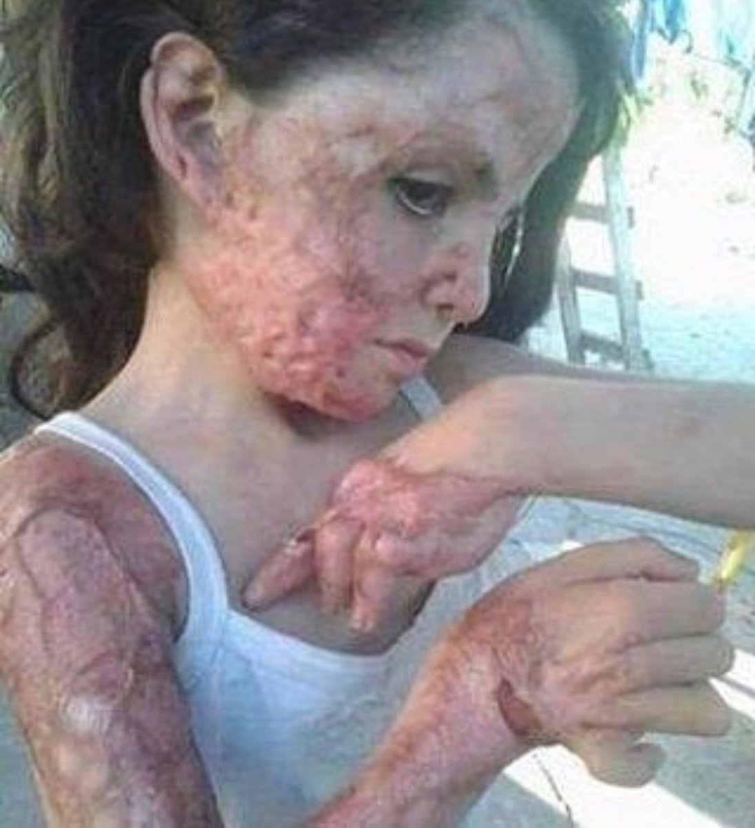 Sadece israil bunu tek başına yapmıyor...