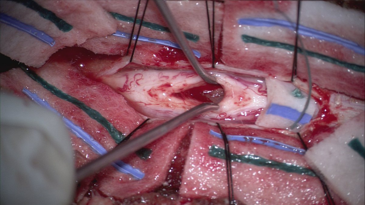 Every day of the week this is not a met.
It turned out to be a met.