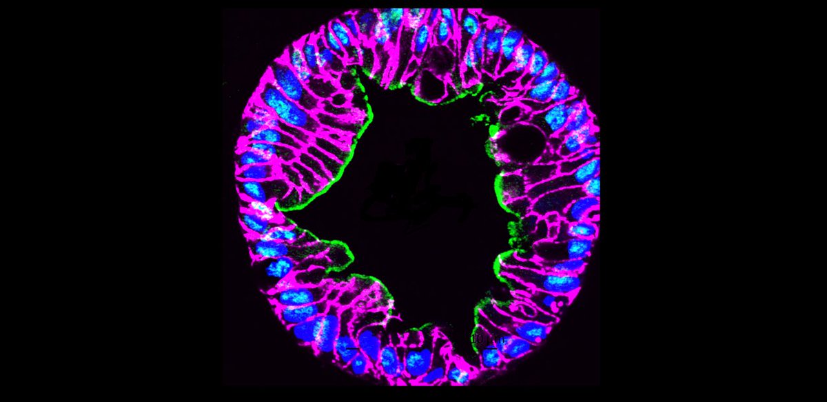 BCMFromtheLabs's tweet image. Did you see our January 2024 #ImageoftheMonth? @bcmhouston @EstesLab_BCM, S. Crawford, Z Liu, H. Smith @huntrsmith et al @bcm_gihep #Organoids blogs.bcm.edu/2024/01/02/fro…