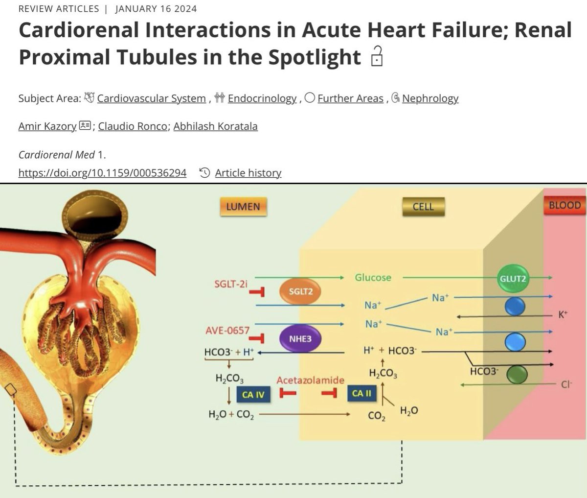 #Cardiorenal Interactions in Acute #HeartFailure; Renal Proximal Tubules in the Spotlight 🔆
- Professor <a href="/AmirKazory/">Amir Kazory</a> &amp; team
🔗 karger.com/crm/article/do…
#Nephpearls #MedEd