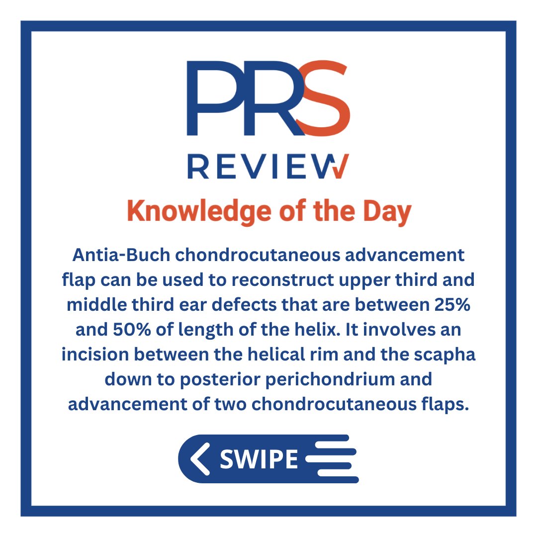 prsreview's tweet photo. Antia-Buch chondrocutaneous advancement flap
#prsreview #antiabuchflap #flapsurgery #flap #earreconstruction #craniofacialsurgery #cancerreconstruction #surgicaloncology #plasticsurgery #reconstructivesurgery #surgicaleducation #medicaleducation #meded #plasticsurgeon #surgery https://t.co/5C9QVPUl7m