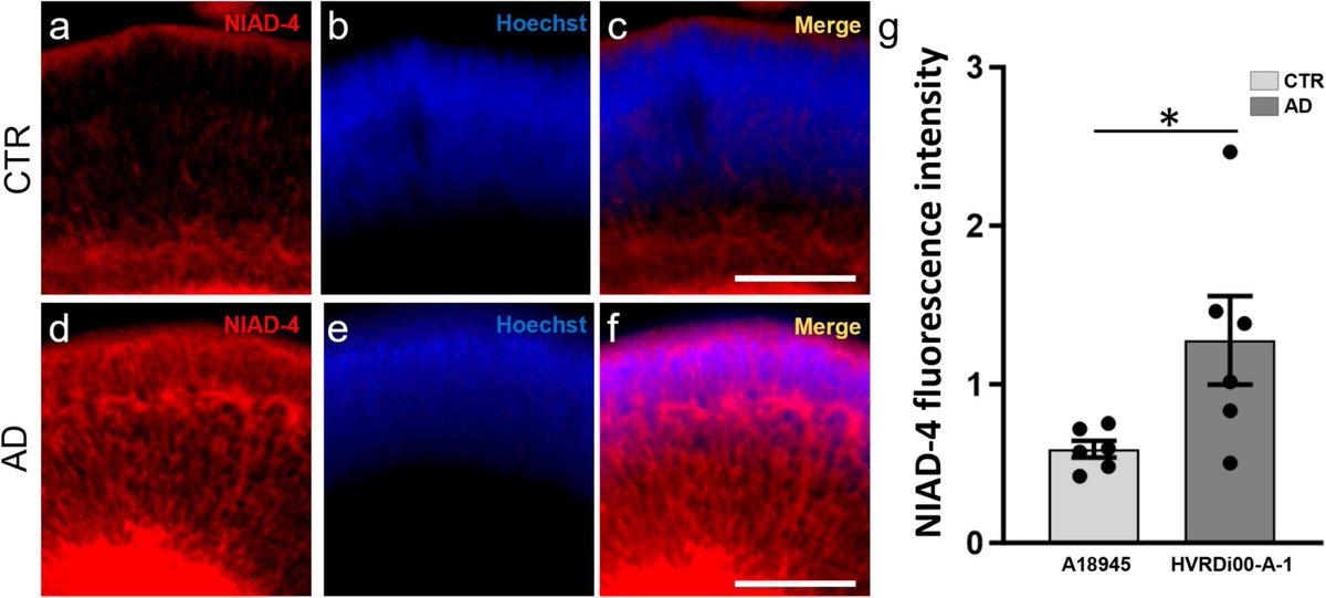 WORC.Community (@organoidsphero1) on Twitter photo 'Human iPSC-derived retinal #organoids develop robust Alzheimer’s disease neuropathology'. Congratulations to the authors: James E, Vielle A, Cusato K, Li H, Lee B, Parween S, Howell A, Johnson NR, Chial HJ, Potter H and Vergara MN organoidspheroid.com/home/f/human-i… via <a href="/OrganoidSphero1/">WORC.Community</a> 'Human iPSC-derived retinal #organoids develop robust Alzheimer’s disease neuropathology'. Congratulations to the authors: James E, Vielle A, Cusato K, Li H, Lee B, Parween S, Howell A, Johnson NR, Chial HJ, Potter H and Vergara MN organoidspheroid.com/home/f/human-i… via <a href="/OrganoidSphero1/">WORC.Community</a>