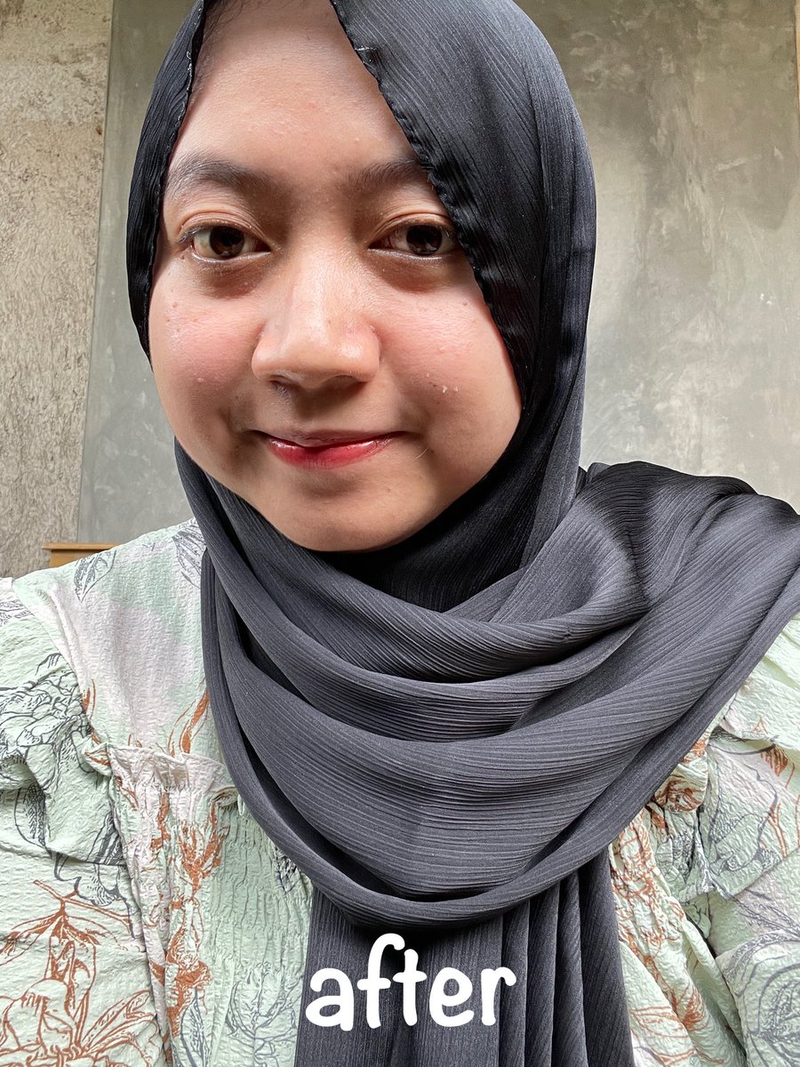 foliskincalters's tweet image. Seneng bgt karena semenjak pake ini, skrng jdi lebih mudah buat reapply sunscreen, cukup 15 detik aja &amp;amp; bisa dipake diatas make up^^

Pake azarine ini super sat-set bgt, tinggal spray spray aja 👌🏻 @AzarineCosmetic 

#racuninskincare  #AzarineCeraspray #AzarineEffortlessProtection