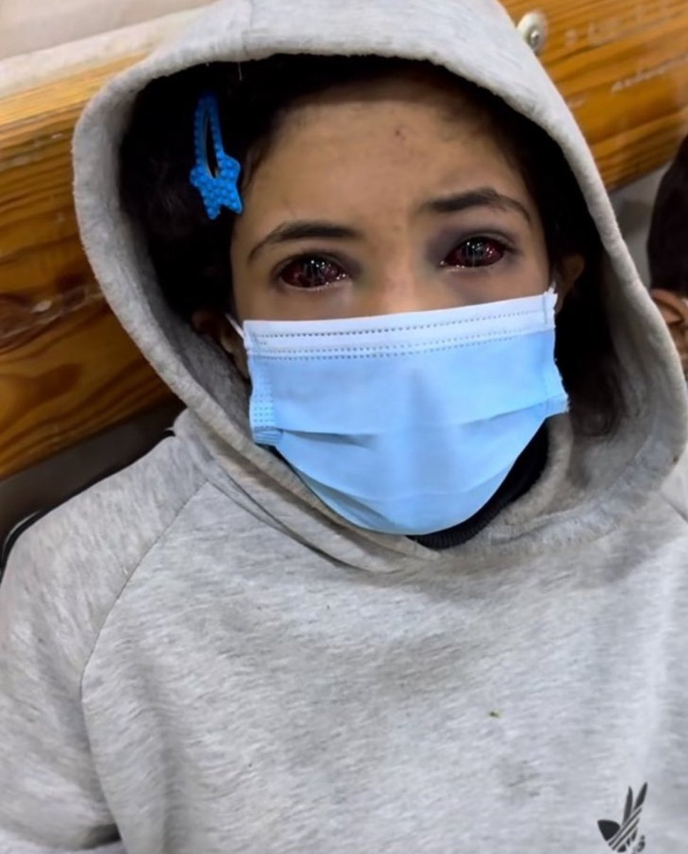 Gazze hakkında konuşmayı bırakmayın. Acımıza alışmayın

Soykırım devam ediyor.