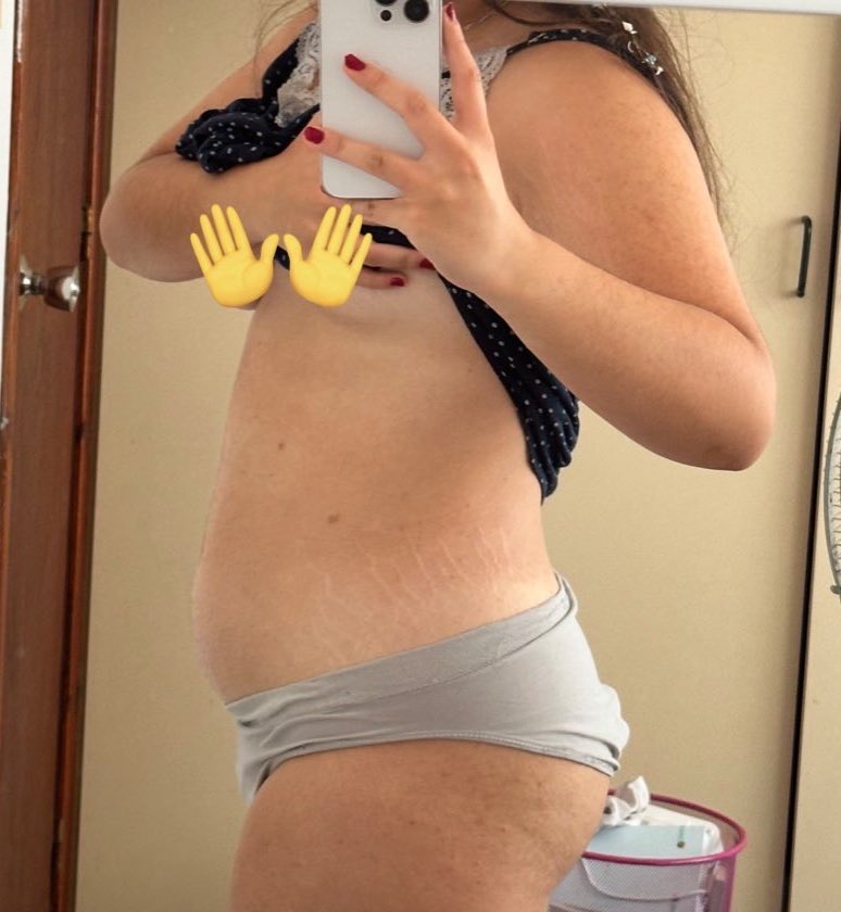 rosielands's tweet image. hilo de como bajé 16kg en 4 meses¡! (hilo largo) lean todo porque TODO es importante si quieren una perdida de peso segura

les aviso q no fue una perdida de peso sana!!!!⚠️⚠️⚠️⚠️