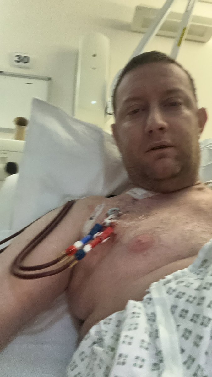 Hello my friend. New #Dialysis access line back in my neck. Back on dialysis. Let’s hope infection all gone #Chronickidneydisease