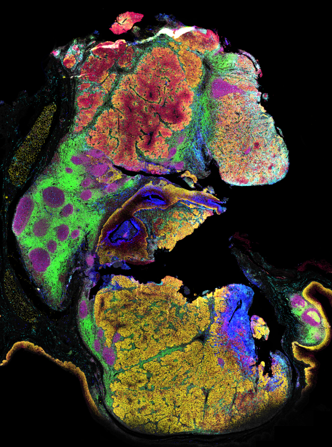 AkoyaBio's tweet photo. "#Spatialphenotyping and #spatialomics are the future of #biology," said Professor John Fraser, Clinical Director at @WesleyResearch's new @Qld_SBC.

He attributes the groundbreaking research at the hospital to QSBC co-lead @Aruthak's expertise & the #PhenoCyclerFusionSystem. https://t.co/123Lu1tXAG
