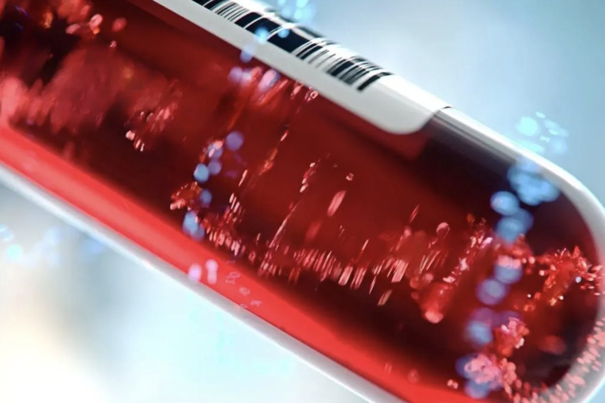 Research affirms high diagnostic accuracy of blood test for Alzheimer’s
ALZpath’s pTau217 test could be as accurate as invasive spinal tap, new study suggests.
#diagnostics #research #bloodtest #alzheimers #pTau217
longevity.technology/news/research-…