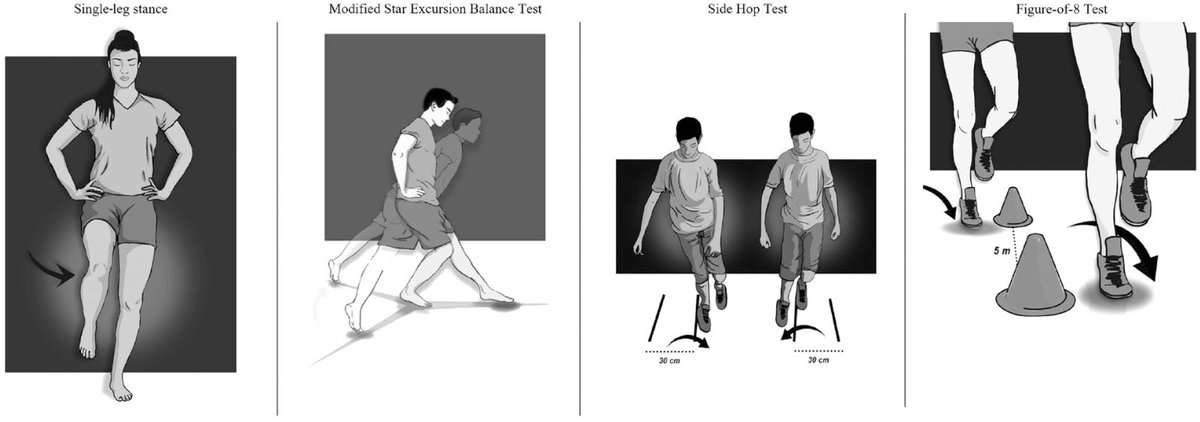 Sports Health: A Multidisciplinary Approach (@sports_health) on Twitter photo Ankle-GO is the 1st objective score to help in #RTS decision making after Lateral Ankle Sprain #LAS and can help predict likeliness of returning to preinjury level. <a href="/PicotBrice/">Brice Picot</a>
#OpenAccess here: ow.ly/r8rP50QrtSX
Share: What RTS criteria do you use for LAS? Ankle-GO is the 1st objective score to help in #RTS decision making after Lateral Ankle Sprain #LAS and can help predict likeliness of returning to preinjury level. <a href="/PicotBrice/">Brice Picot</a>
#OpenAccess here: ow.ly/r8rP50QrtSX
Share: What RTS criteria do you use for LAS?