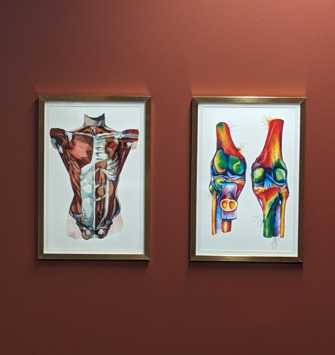 #RadArt, curated by @kjpacheco79 and fancifully hung in our Radiology suite. Visually-inclined, as a rule, our sights are set on empowering a new Arts & Medicine gallery @ USC🤞! 👀 That means we're interested in hearing from creatives like YOU in the med community! ♥️🎨 1/2