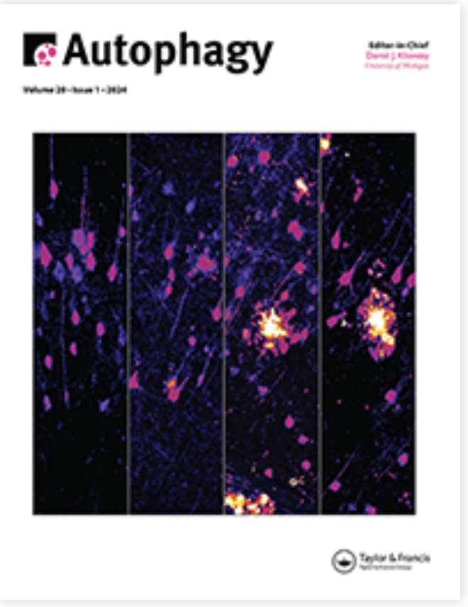 OuryLAB's tweet photo. Happy to present a new collaborative work between @OuryLAB @NeckerInem and S. Pervaiz’s group @NUSingapore showing the role of a novel mTORC2-AKT-ROS axis triggering mitofission and mitophagy-associated execution of COLORECTAL CANCER CELLS
DOI: 10.1080/15548627.2024.2307224 https://t.co/CgyxCrq05B