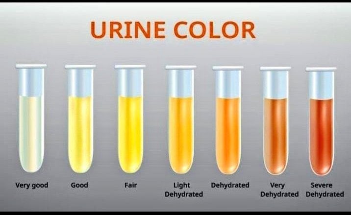 Are you dehydrated ?
Pl Check your urine colour !
#HealthTip #Fitistan #EkFitBharat