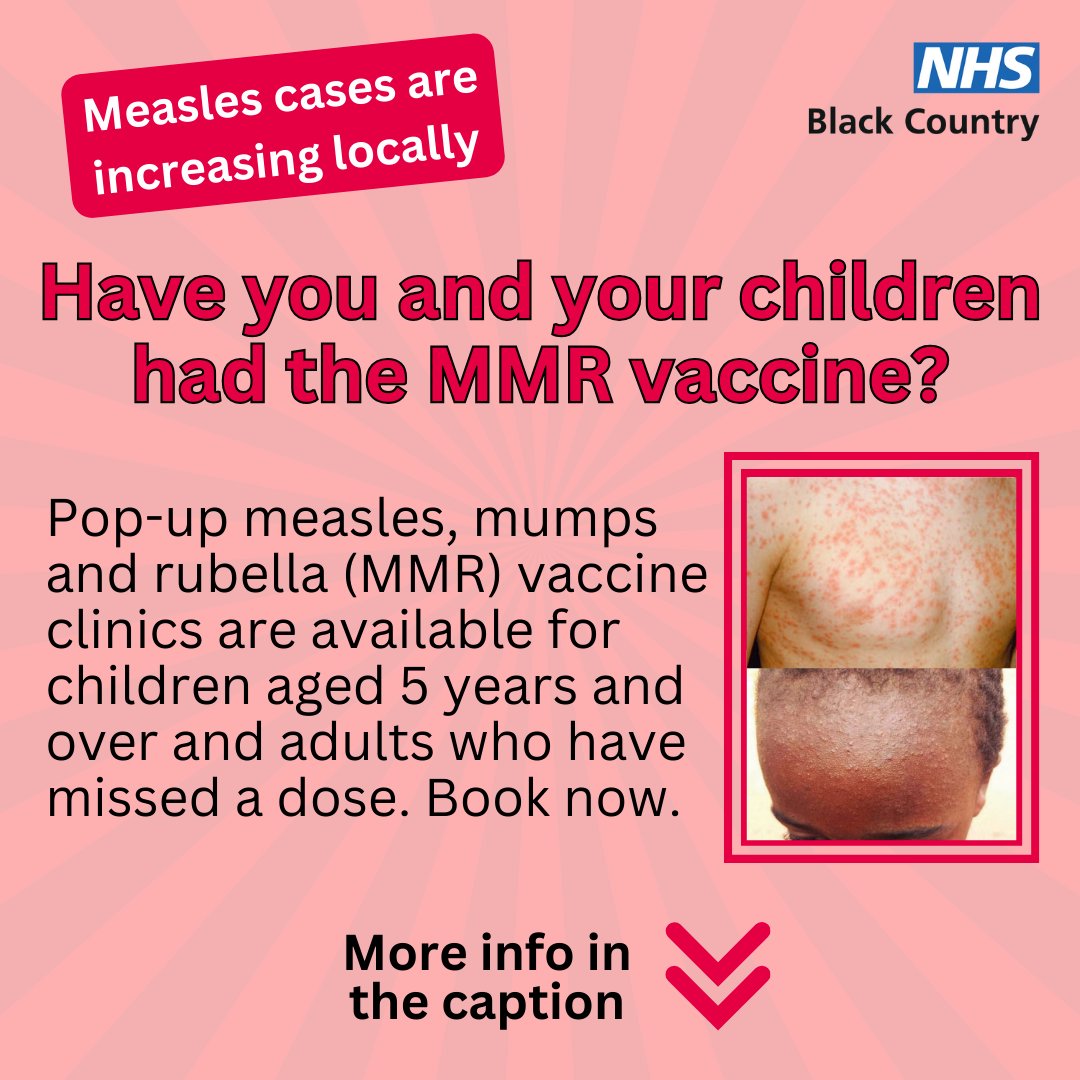 NHS Black Country Integrated Care Board (ICB) (@nhsinblkcountry) on Twitter photo 1 in 5 children with measles need a hospital visit. It can spread very easily & can cause serious problems.
Two doses of the MMR vaccination is the best way to stay protected.
Find a local pop-up vaccine for you & your child at blackcountry.icb.nhs.uk/your-health/he…
#BlackCountryHealth247 1 in 5 children with measles need a hospital visit. It can spread very easily & can cause serious problems.
Two doses of the MMR vaccination is the best way to stay protected.
Find a local pop-up vaccine for you & your child at blackcountry.icb.nhs.uk/your-health/he…
#BlackCountryHealth247