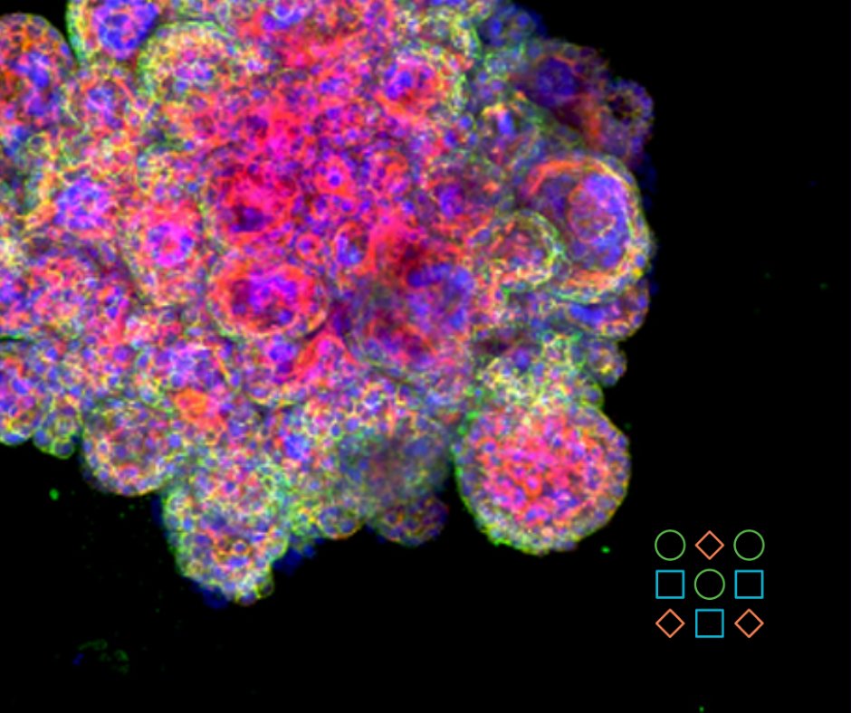 PET_BioNews's tweet photo. A #placenta model is enabling scientists to better understand the underlying cause of reproductive disorders, including #preeclampsia, #stillbirth and #growthrestriction.
Vanessa Burns writes for BioNews: https://t.co/tvShGdX46V
#pregnancy #fertility #infertility #TTC https://t.co/lys7ETPAoU