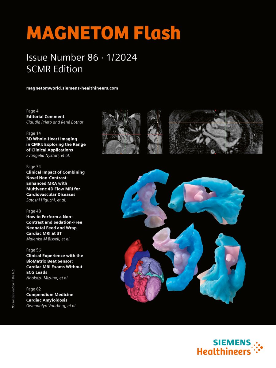 Antje Hellwich @antjehellwich.bsky.social (@antjehellwich) on Twitter photo Embracing the Power of #Collaboration we are thrilled to present the #CMR2024 edition of MAGNETOM Flash. With an Editorial Comment by <a href="/MRI_CPrieto/">Claudia Prieto</a> and <a href="/rbotnar/">Rene Botnar</a> (<a href="/KingsCollegeLon/">King's College London</a>, UK). magnetomworld.siemens-healthineers.com/publications/m…
#magnetomworld #WhyCMR #MRI <a href="/SiemensHealth/">Siemens Healthineers</a> Embracing the Power of #Collaboration we are thrilled to present the #CMR2024 edition of MAGNETOM Flash. With an Editorial Comment by <a href="/MRI_CPrieto/">Claudia Prieto</a> and <a href="/rbotnar/">Rene Botnar</a> (<a href="/KingsCollegeLon/">King's College London</a>, UK). magnetomworld.siemens-healthineers.com/publications/m…
#magnetomworld #WhyCMR #MRI <a href="/SiemensHealth/">Siemens Healthineers</a>